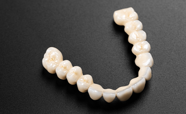 セラミック矯正