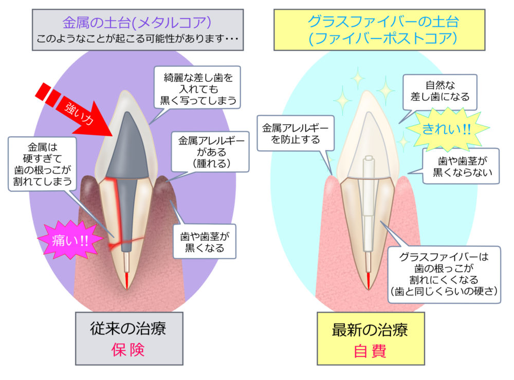 ファイバーコア