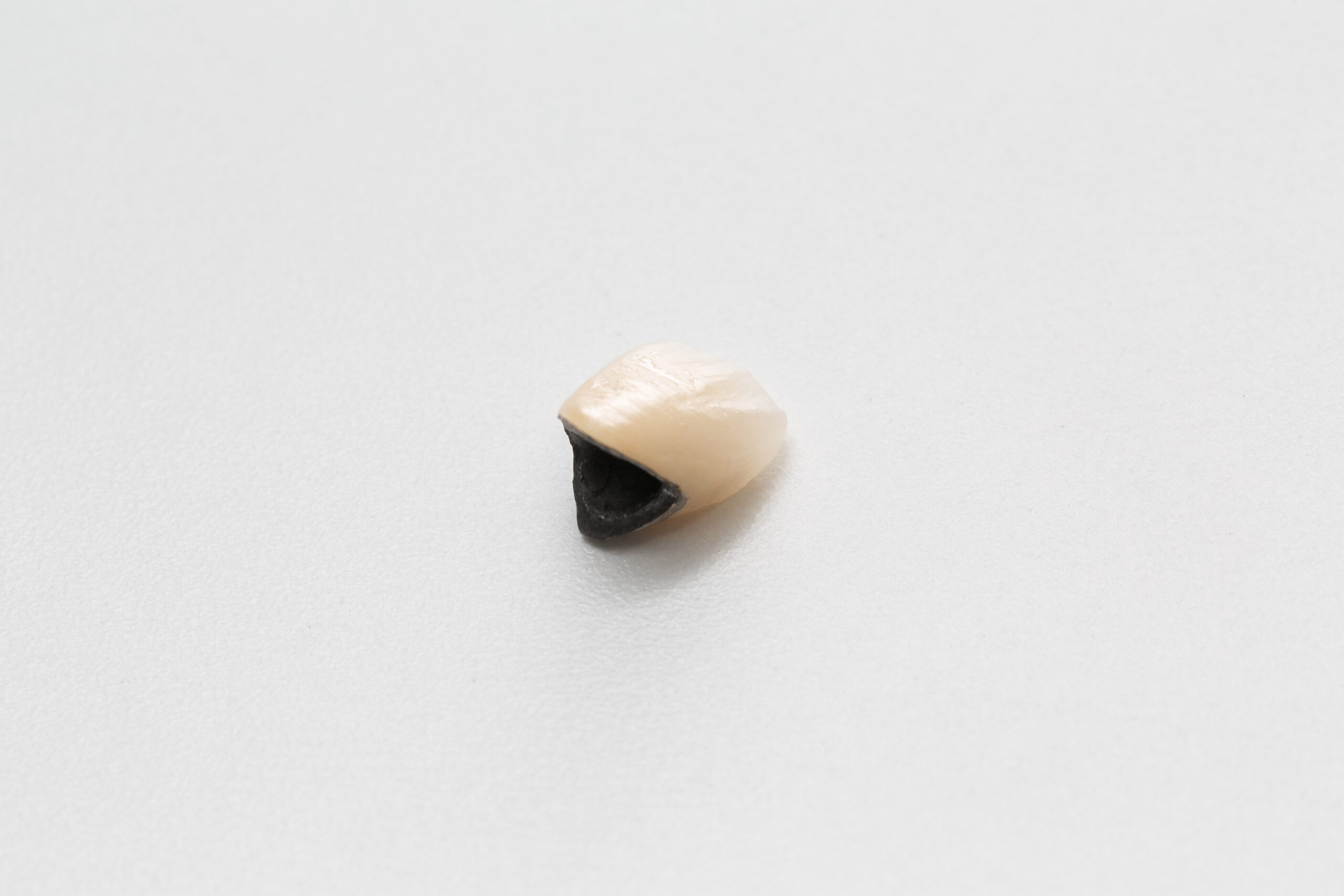 硬質レジン前装冠